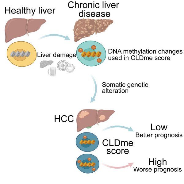 Hepatocellular carcinomas (HCCs) usually arise from chronic liver disease (CLD). Pre-cancerous cells in chronically inflamed environments may be 'epigenetically primed', sensitizing them to oncogenic transformation.