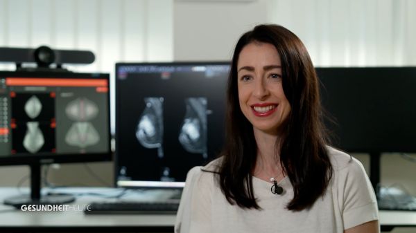 Brustkrebs ist die häufigste Krebserkrankung bei Frauen. Am Universitätsspital Basel setzen wir auf strukturierte Brustkrebs-Screening-Programme und moderne Mammadiagnostik, um Erkrankungen frühzeitig zu erkennen und die Heilungschancen deutlich zu verbessern.