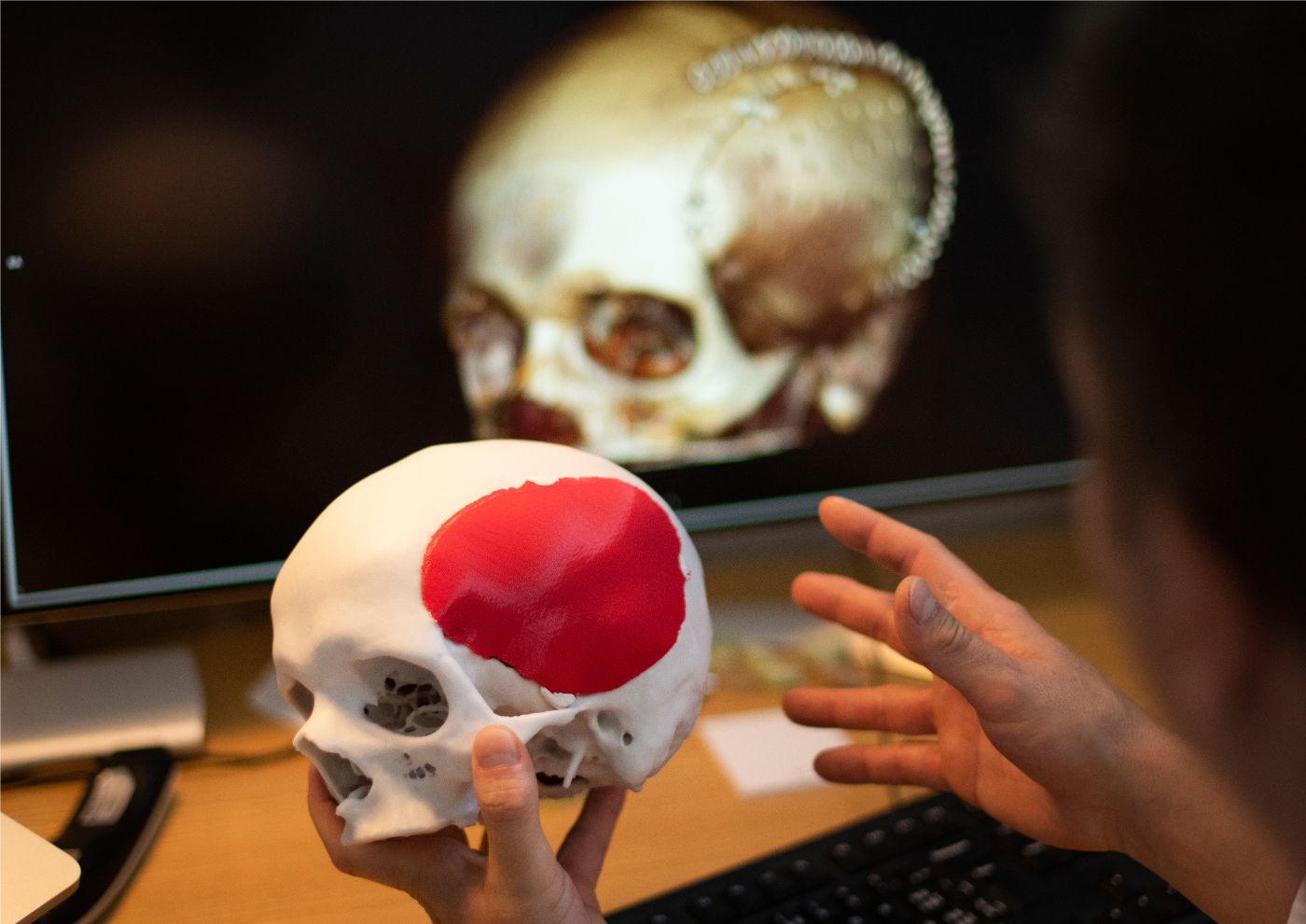 3D-Modell eines künstlichen Implantats einer Schädelplatte