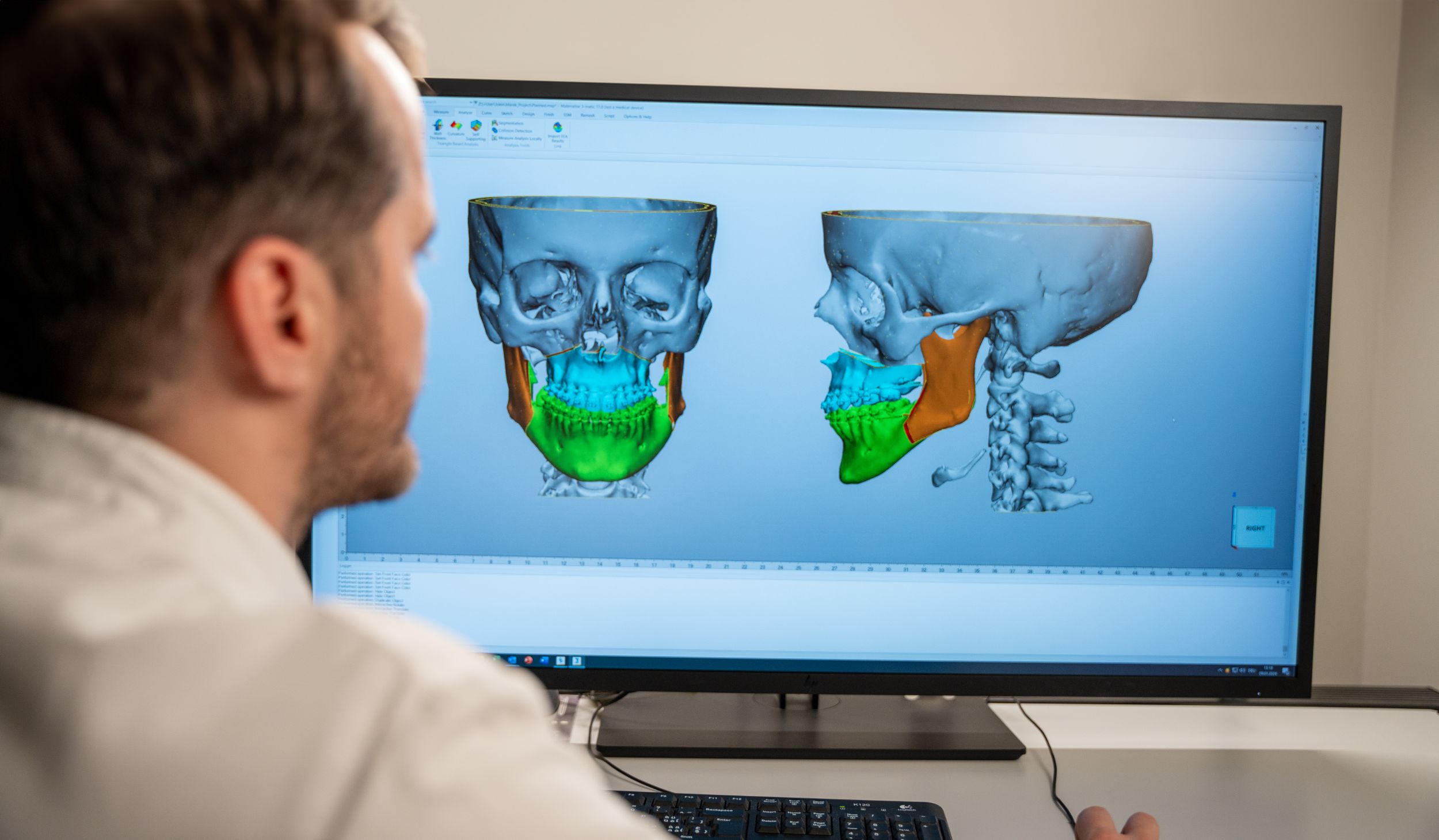 3D-Aufnahme eines Patienten mithilfe einer 3D-Kamera auf Bildschirm