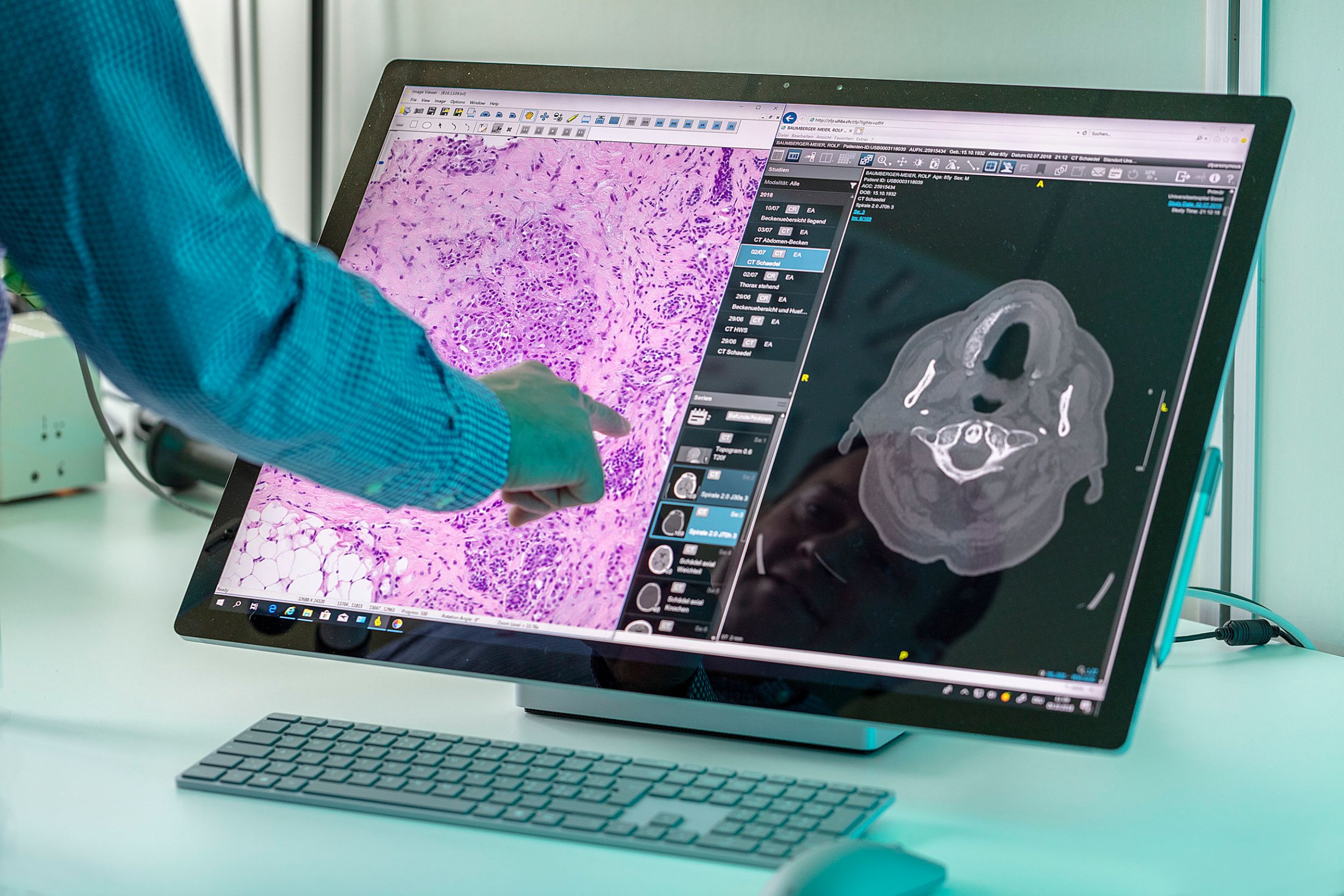 Bildschirm mit digitalen Pathologie-Aufnahmen