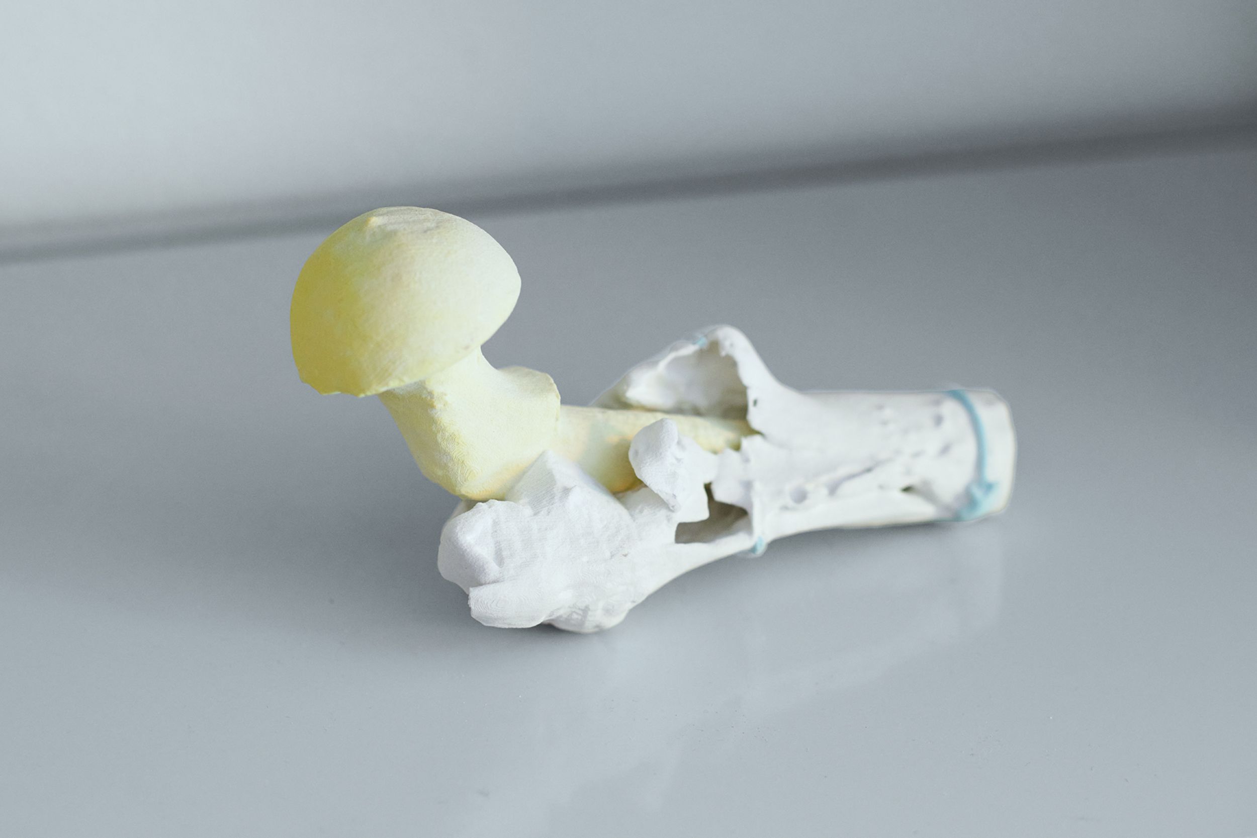 Nahaufnahme einer 3D-gedruckten Gelenkprothese