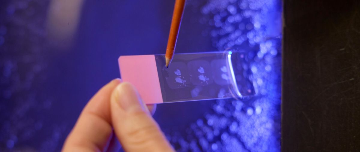 Forschende betrachten Gewebeproben unter Mikroskop