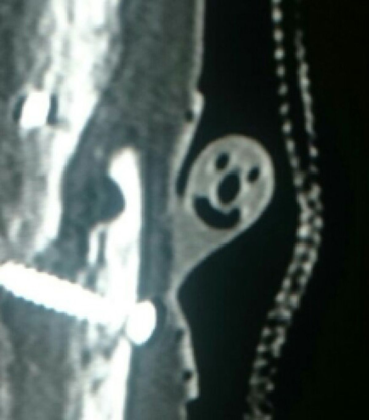 Röntgenaufnahme mit Smiley