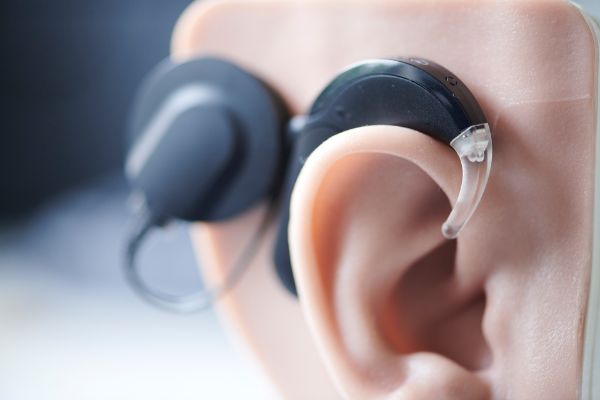 Cochlea-Implantat auf Ohr-Modell