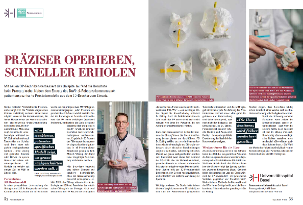 Verbesserte Behandlungsergebnisse mit Prostatamodellen aus dem 3D-Drucker 
